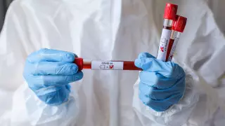 Италияда вакцинаға төтеп бере алатын коронавирус штамы анықталды