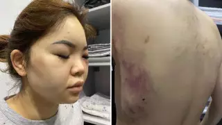 Астаналық әйелді бұрынғы күйеуі оңдырмай сабап тастаған