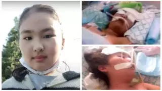 Шымкентте қарапайым ота жасатуға келген қыз өлім аузында жатыр