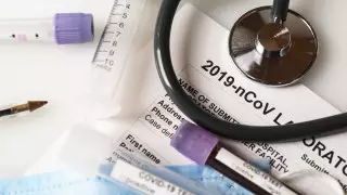 Коронавирус жұқтырғаннан кейін адам ағзасында қандай өзгеріс болады?