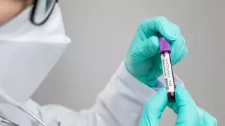 Қазақстанда кейінгі тәулікте 4568 адамнан коронавирус анықталды