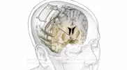 Ғалымдар депрессиямен күресуге арналған ми имплантын ойлап тапты