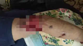 "Тістеген жерін жұлып алған". Павлодар облысында ит тұрғынға шабуыл жасады