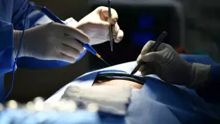 Қазақстанда жыл сайын 270 адам органға жете алмай қайтыс болады - депутат