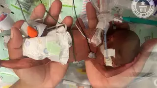 АҚШ-та ерте босану бойынша әлемдік рекорд орнатылды