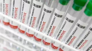 Қазақстанда COVID-19 жұқтырғандар саны неге артқаны айтылды