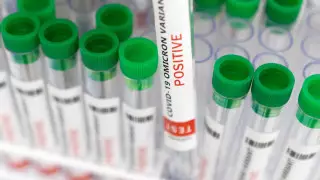 Нұр-Сұлтанда бір ай ішінде коронавирус жұқтырғандар саны бойынша антирекорд тіркелді