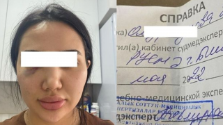 Сурет: 24.kg