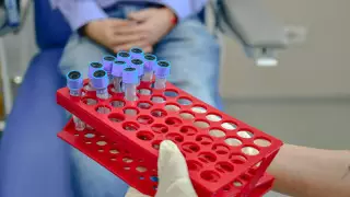 Қазақстан маймыл шешегін анықтайтын сынамалар сатып алды