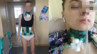 Алматыда күйеуінен қорлық көрген әйел әділдік іздейді