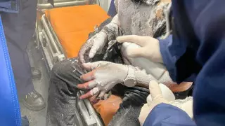 Павлодарда денесін күйік шалған әйелдің балалары өрт жайлы айтып берді