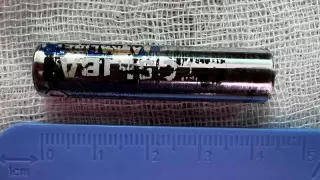 Алматыда баланың асқазанынан батарея операциясыз алынды