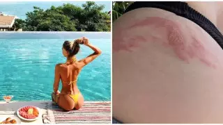 Балиде туристі жәндік "шағып", ауыр жара салды