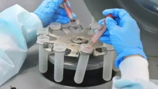 Алматы ауруханасында науқастар АИТВ жұқтырған: Денсаулық сақтау министрлігі тергеуді бастады