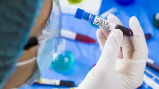 ДСМ басшысы Алматыдағы ауруханада АИТВ инфекциясын анықтауға қатысты пікір білдірді