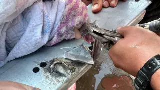 Құтқарушылар 10 жастағы қыздың саусағын аман сақтап қалды