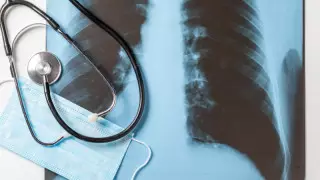 Қазақстанда туберкулезбен сырқаттану және өлім-жітім азайып келеді