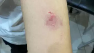 "Мұғалім де сол жерде болды". Мектеп оқушысын сабақ кезінде ит тістеп алды