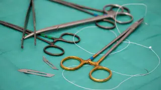 Дәрігерлер әйелге ота жасаған кезде ішінде жіпті ұмытып кеткен