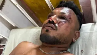 Үндістандағы ұшақ апаты: жалғыз аман қалған жолаушы оқиға туралы айтты