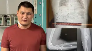 Шымкент әкімінің орынбасары Руслан Берденовке екінші ота жасалмақ