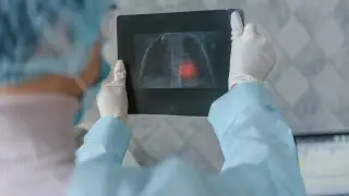 Астана мен Алматыдағы екі университет студенттерінен туберкулез анықталды