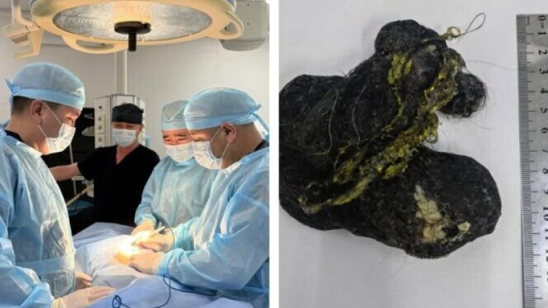 Фото: Шымкент Денсаулық сақтау басқармасы