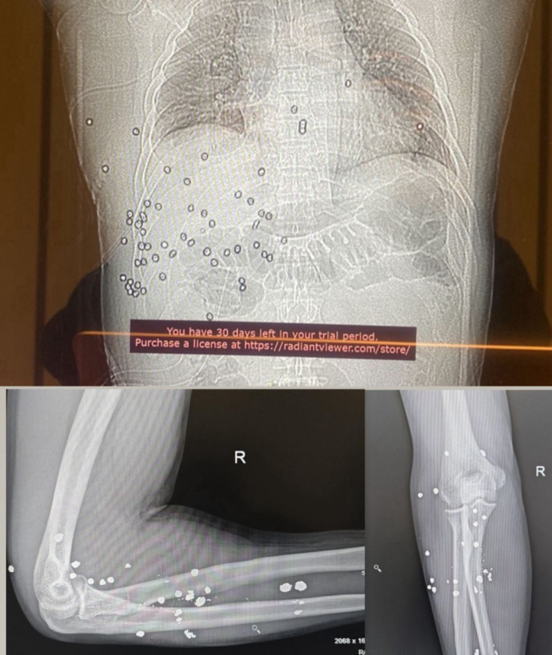 Желідегі порнороликтер